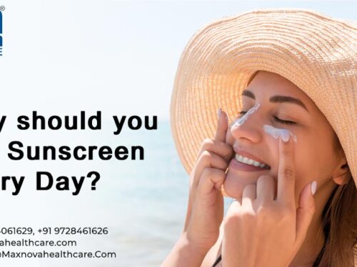 Why Should you use Sunscreen Every Day?