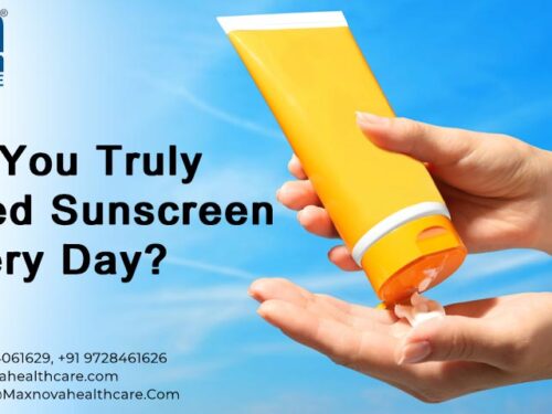 Do You Truly Need Sunscreen Every Day?
