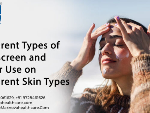 Different Types of Sunscreen and Their Use on Different Skin Types